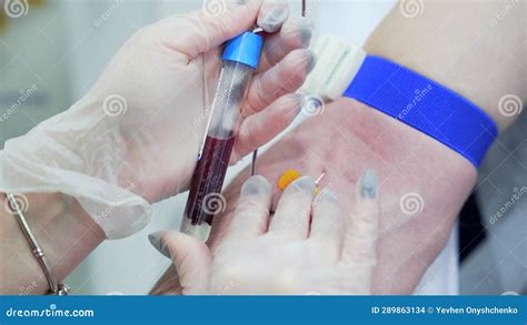 an adult patients blood sample is analyzed in a laboratory|blood sampling in nursing.